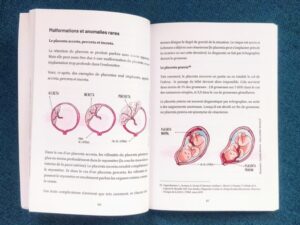 Illustrations du livre "le placenta délivré"